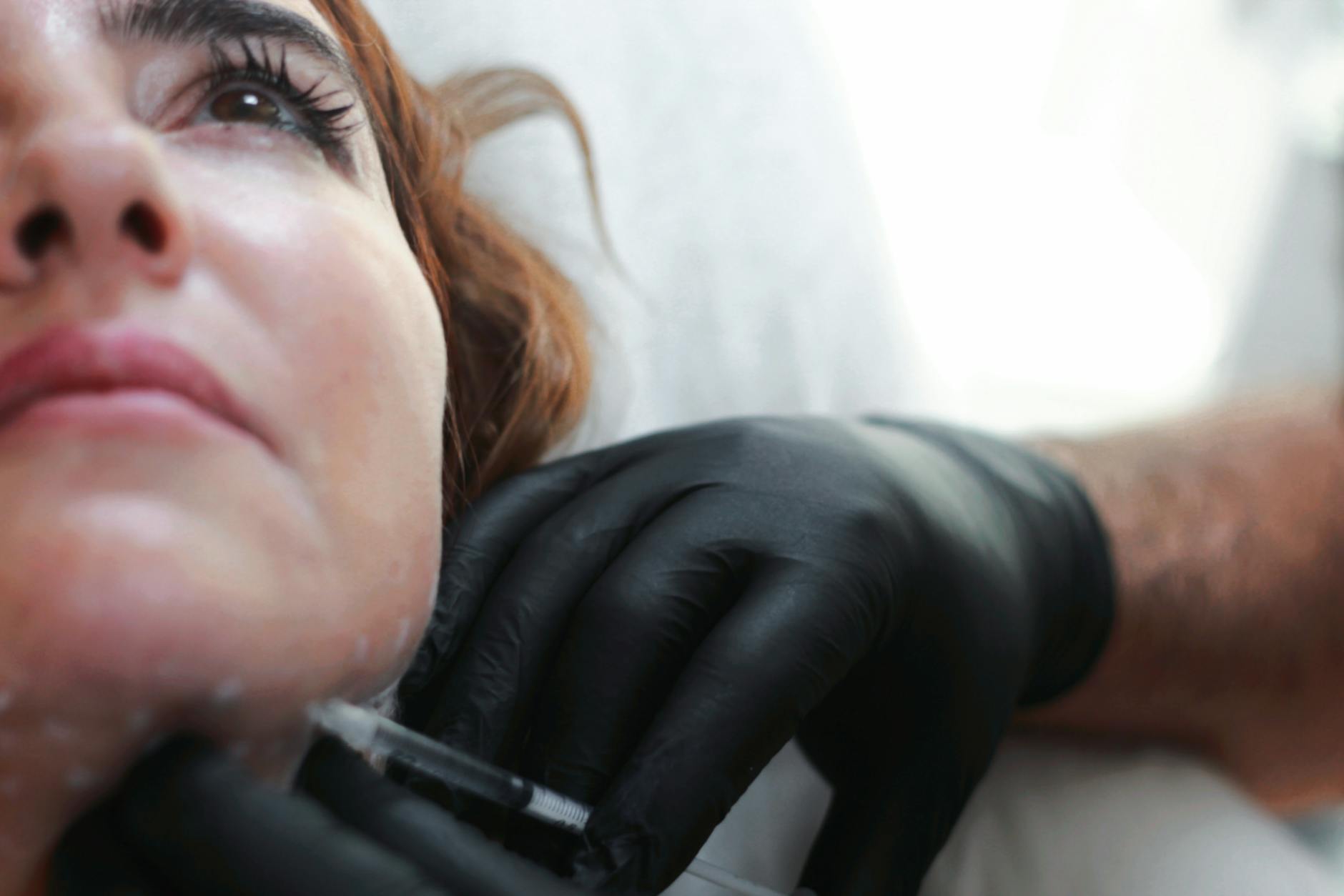 close up of a woman during an aesthetic medicine procedure